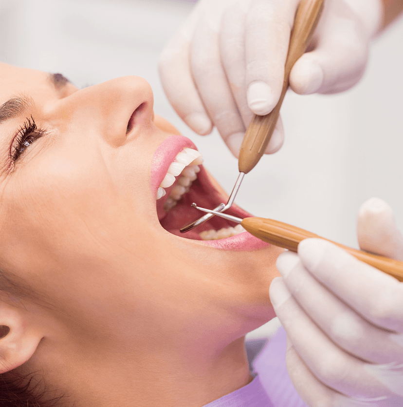 Dental Fillings